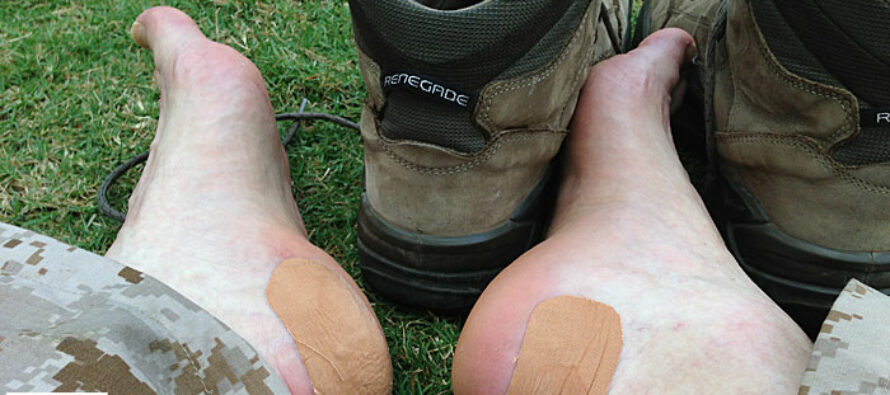 How To Take Care Of Your Feet And Prevent Blisters